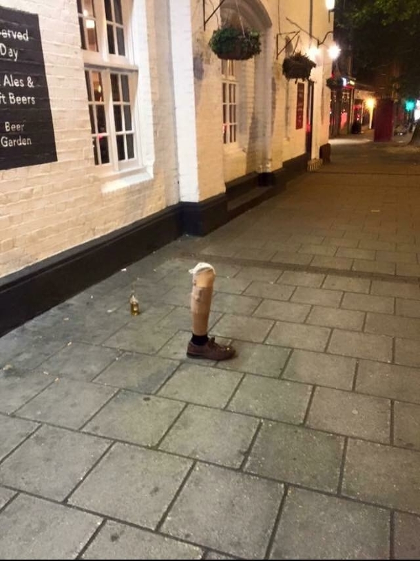 Ever been so drunk you left your leg outside the pub