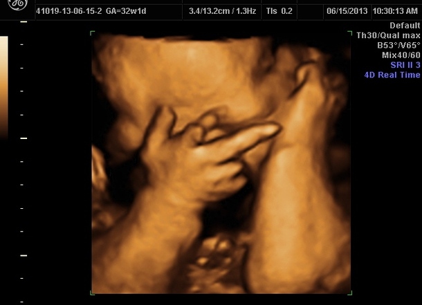 Had a D ultrasound yesterday he made it clear how he felt about having his picture taken