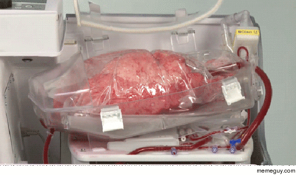 How a human lung is kept alive and breathing for a transplant
