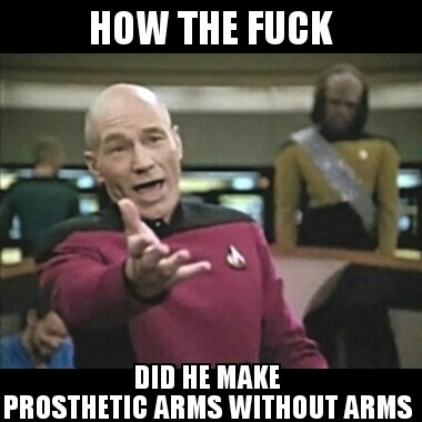 In response to the civil war soldier with the prosthetic arms