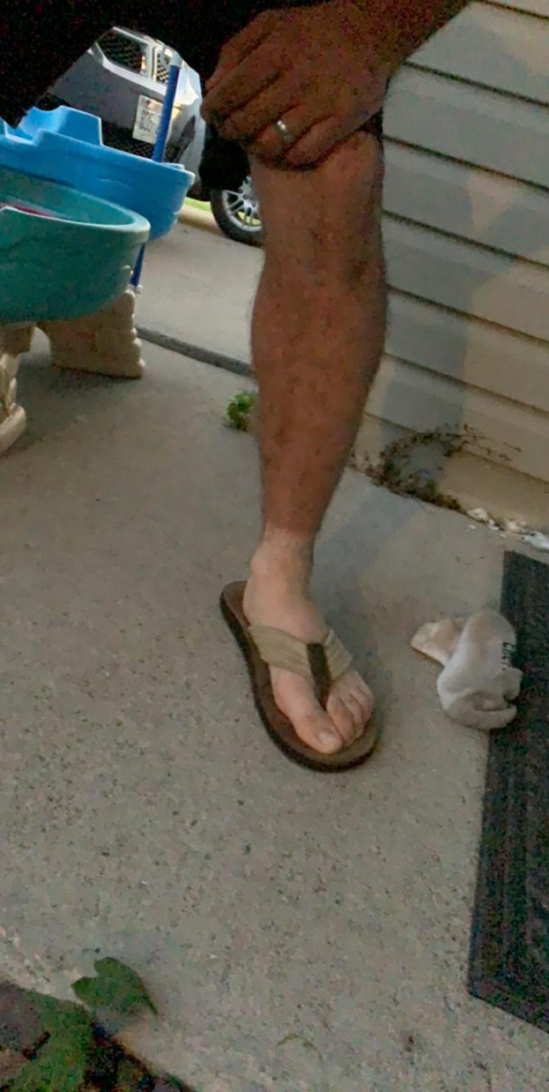 My husbands first time wearing sandals since starting his new asphalt job