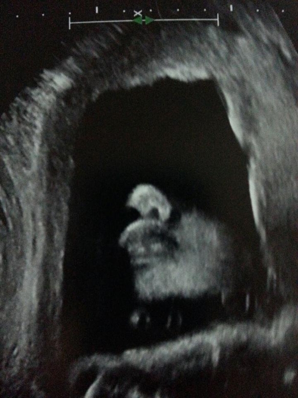 Our baby looks like a Sith Lord