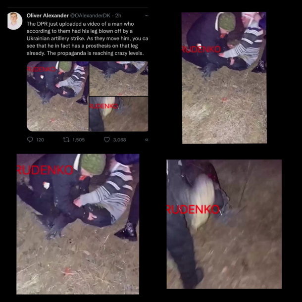 The Donetsk Peoples Republic aka DPR Russia backed separatist just uploaded a video of a man who according to them had his leg blown off by a Ukrainian artillery strike As they move him you can see that he in fact has a prosthesis on that leg already The 