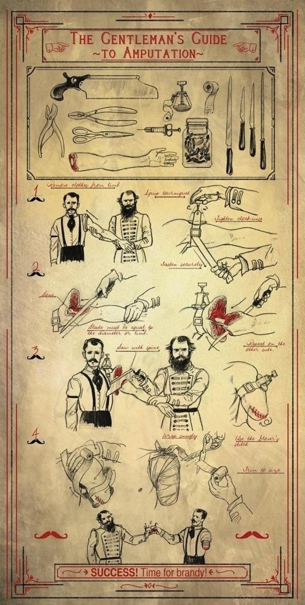 The Gentlemans Guide To Amputatuion