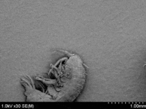 A bacterium on a diatom on an amphipod