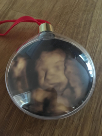 BIL got a scan of his baby put in a bauble It looks like theyve been imprisoned in the phantom zone