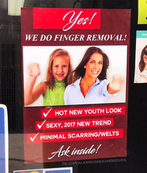 Finger Removal