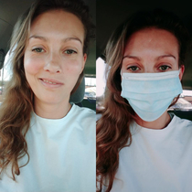 Grateful for masks today post dental appointment left me a little two faced