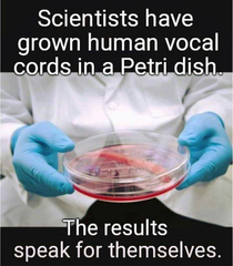 Human vocal cords recreated in lab using stem cells