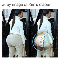I didnt know she had a diaper