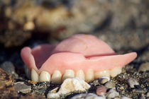 I found a denture on the beach on my vacation someone search it