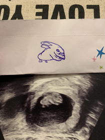I found out Im going to be an uncle My sister wasnt too happy about my interpretation of her upside down ultrasound