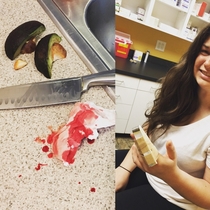 I see your girlfriends avocado cutting skills I raise you MY girlfriends avocado cutting skills