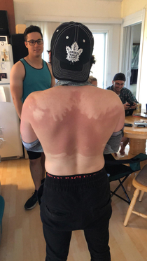 My friend refused to ask for help with putting sunscreen on this is the result