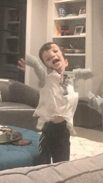My friends kid jumped during a panorama and now hes Quasimodo