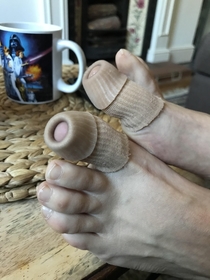My gfs toes with toe protectors on look like something totally different