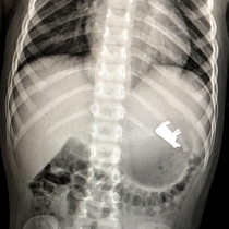 My  year old nephew swallowed a cow today