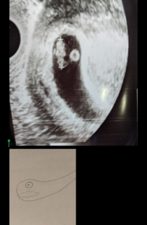 Shared an image of our ultrasound for our first baby friend replied I have drawn a picture to remember them forever in this stage