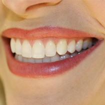 The Brits are asleep Post pictures of nice teeth