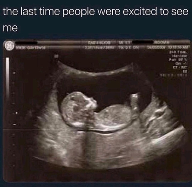 B-