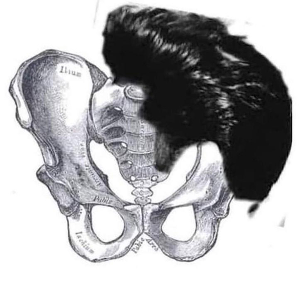 Pelvis