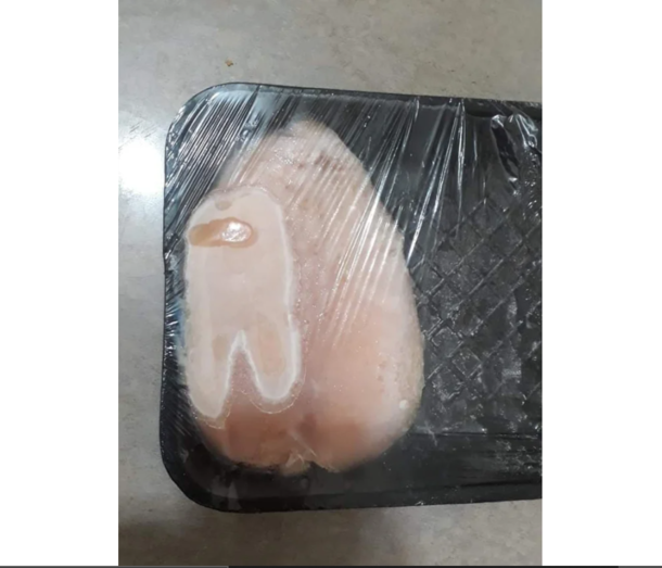 YO