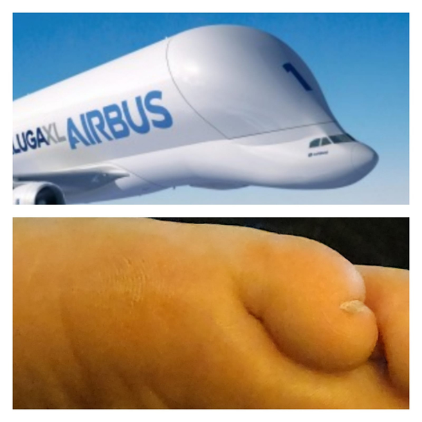 According to my partner my toe and the plane have a striking resemblance