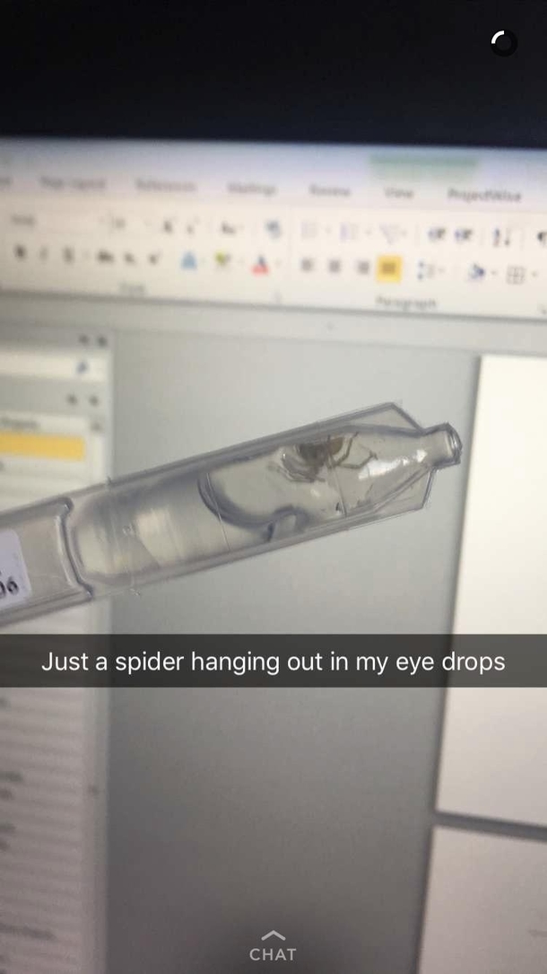 All eight of its eyes mustve been very dry