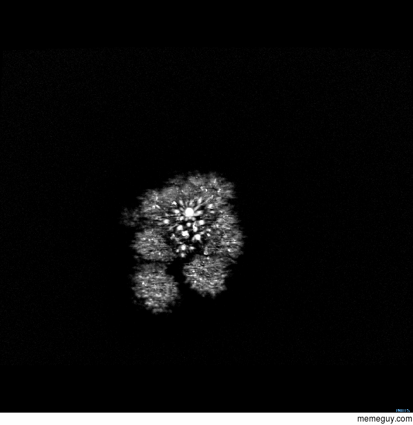 An MRI scan of Broccoli