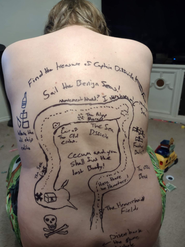 Arr tis a colonoscopy adventure my doctor will never forget