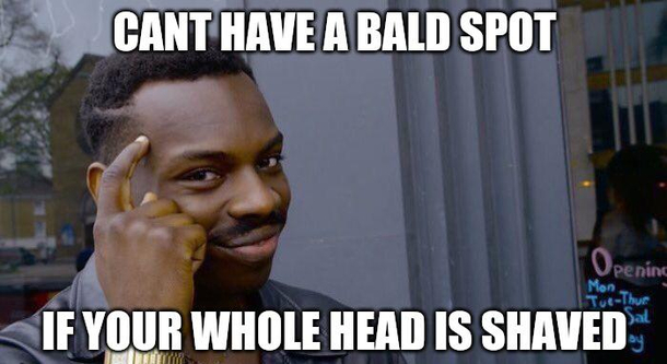 As a  year old male with a receeding hairline and huge bald spot