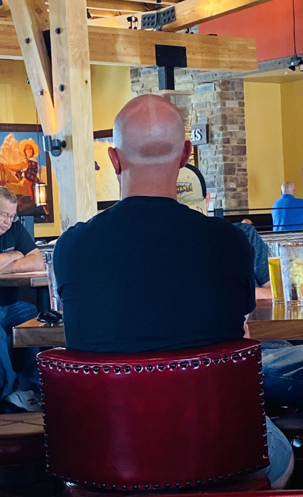 Baldies Beware