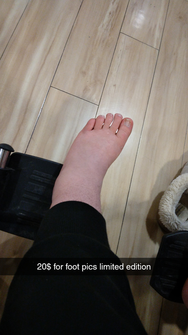 Breaking my ankle hasnt lessen my genius humour