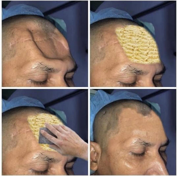 Breakthrough in medical science