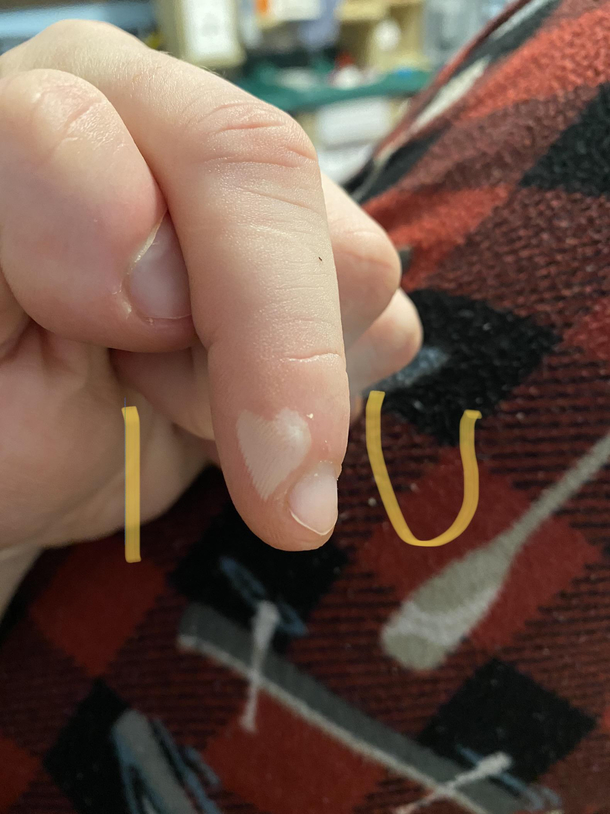 Burned my finger sent this to my wife