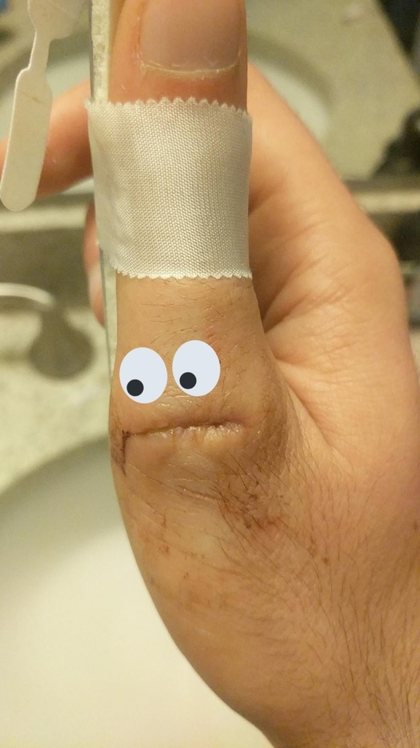 Cut my thumb the other day havent heard a word from it since