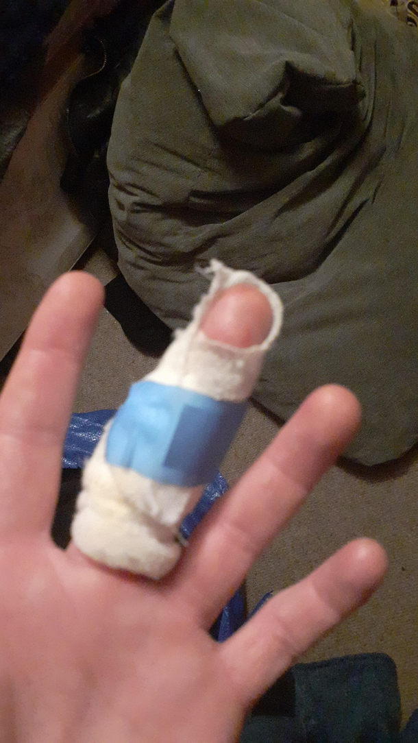 Cut myself at work and am getting strong nativity baby Jesus vibes from my hand