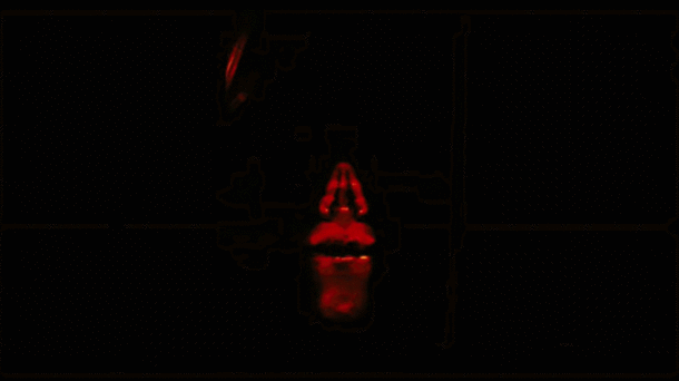 Dat Scan