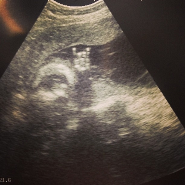 Friends sonogram rock on little dude