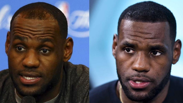 Goal Become so rich that your hairline comes back
