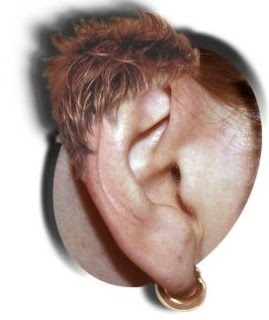 Googled earwig and this came up