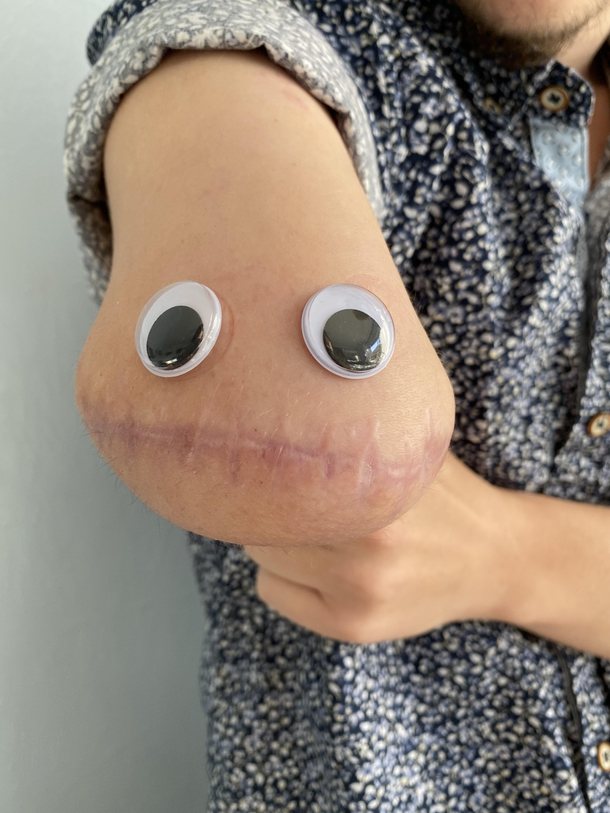 Googly eyes make everything better