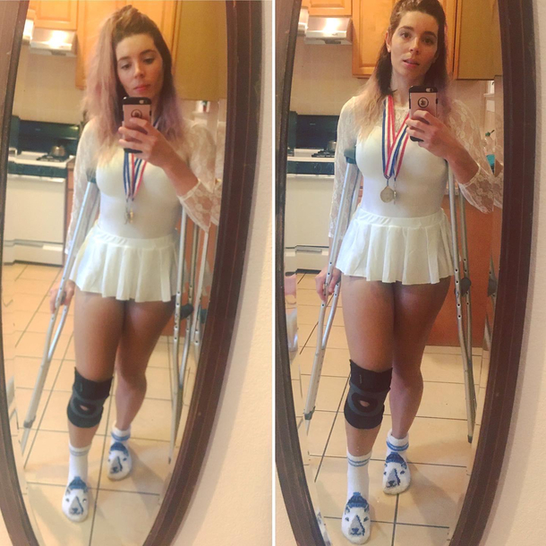 Had hip surgery on Wednesday so great timing for a Nancy Kerrigan costume