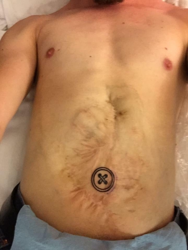 He always wanted a belly button