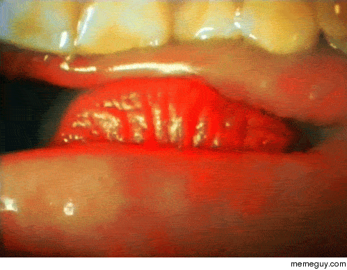 How a kiss looks from inside the mouth