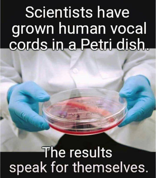 Human vocal cords recreated in lab using stem cells