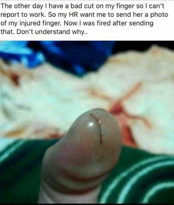 I dont understand Its index finger