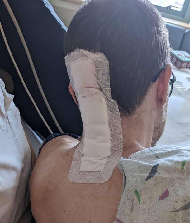 I had brain surgery and the bandage looks like a womans pad