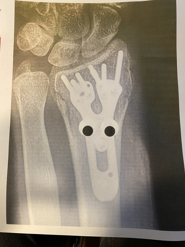 I put googly eyes on my roommates x-ray