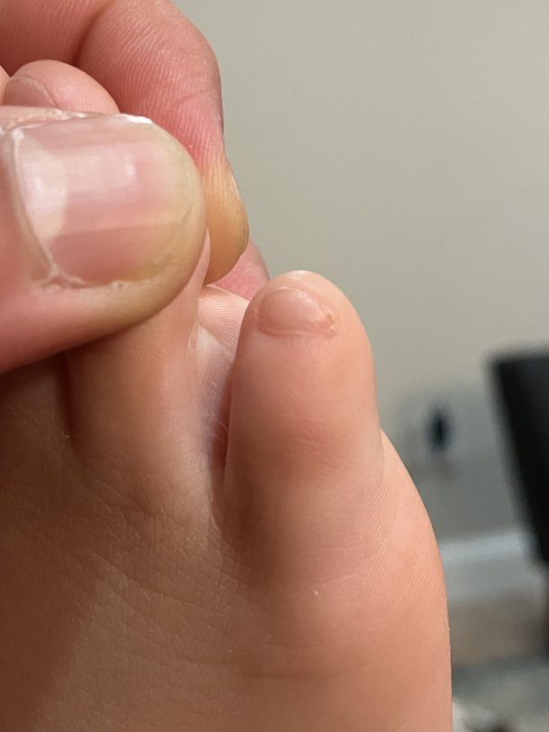 I told my  yr old his pinky toe looks like an Among Us character and we havent stopped laughing since